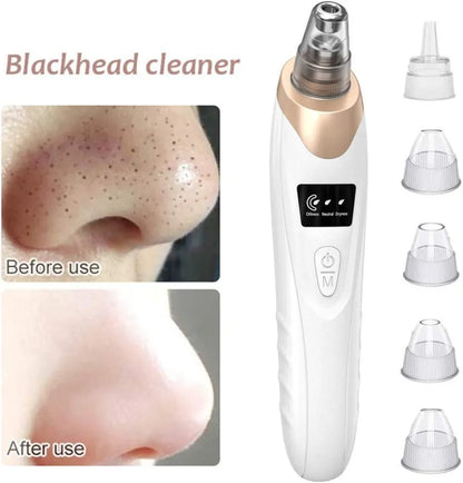 5 In 1 Blackhead Remover Machine Rechargeable Pore Cleaner - Skincare Device Designed For Pore Cleansing And Daily Beauty